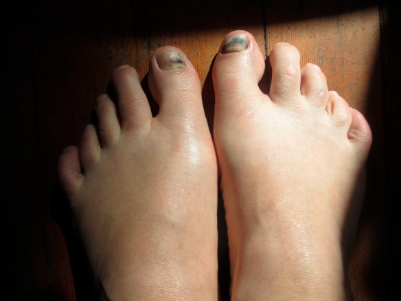 My feet after 48 miles of hiking along the John Muir Trail